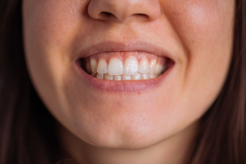 Addressing Minor vs. Major Teeth Misalignments: Treatment Options