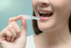 How to Clean and Maintain Clear Aligners at Home in the UK