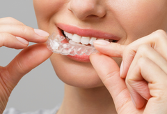 Ready for Clear Aligners? How UK Patients Can Start Today