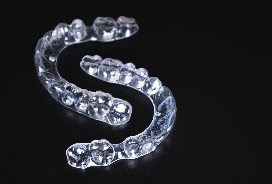 Clear Aligners with Monthly Payments: UK Options Explained