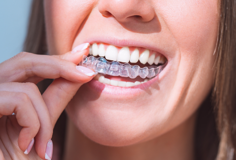 Best Long-Term Teeth Straightening Solutions in the UK