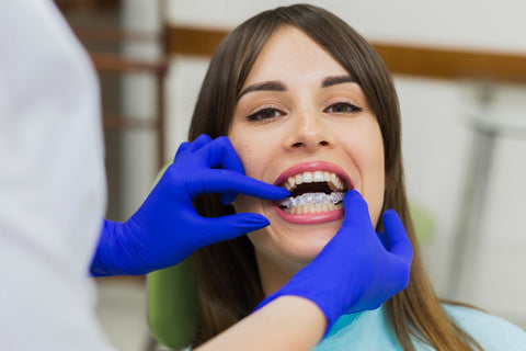 Teenagers and Clear Aligners: Balancing School, Sports & Social Life