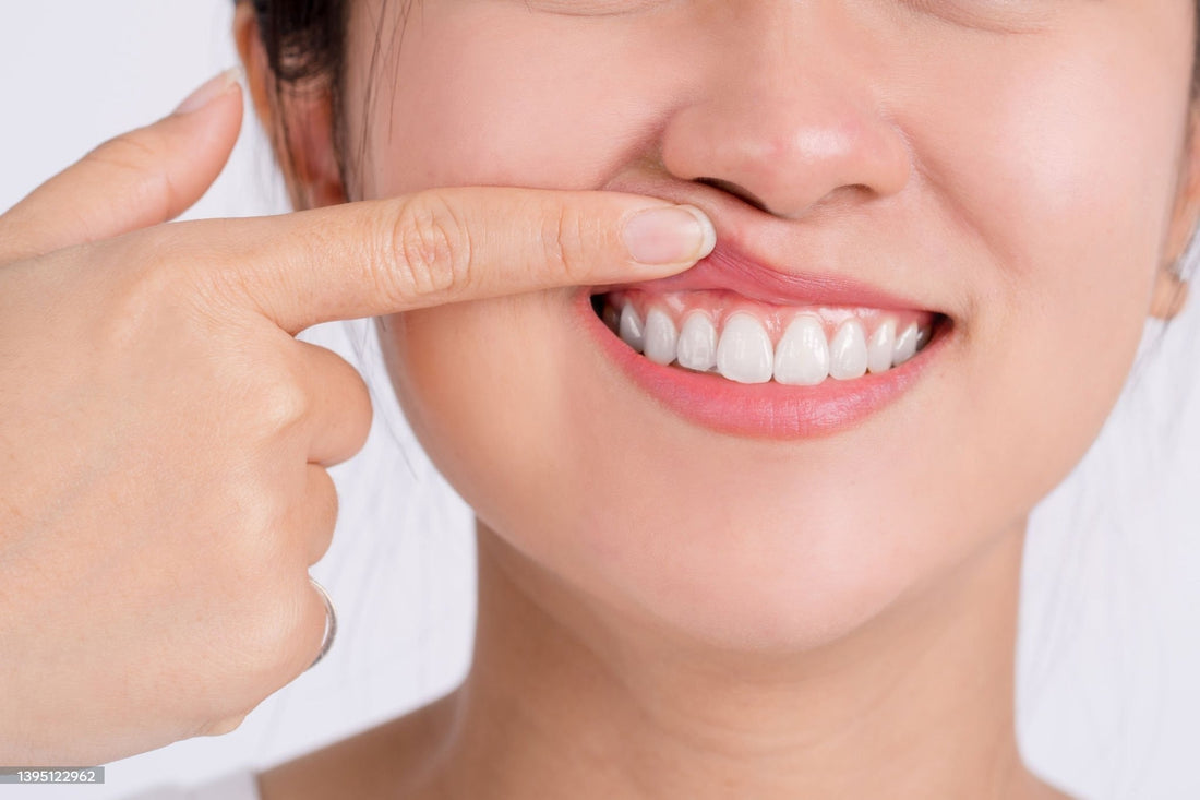 Understanding Gum Disease: Prevention and Treatment