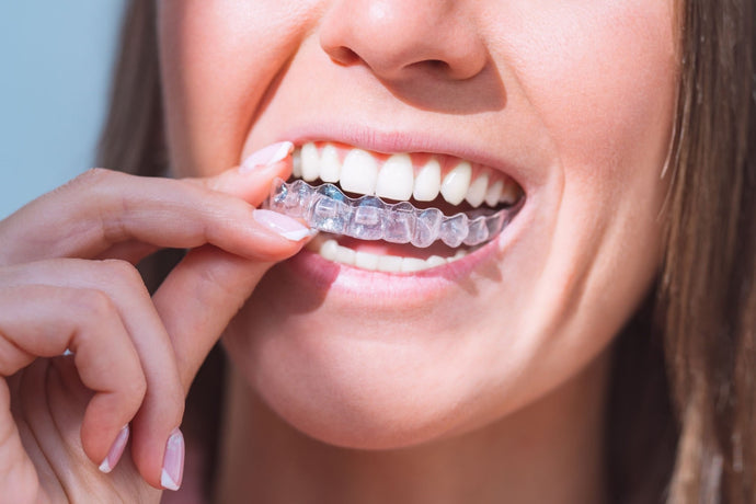 How to Care for Your Clear Aligners: Cleaning and Maintenance Tips