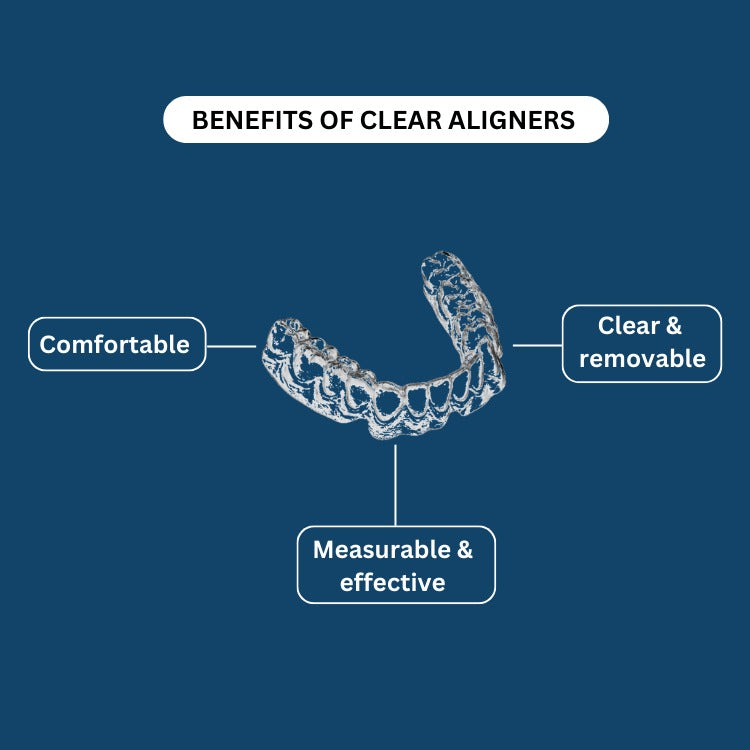 Benefits of clear aligners