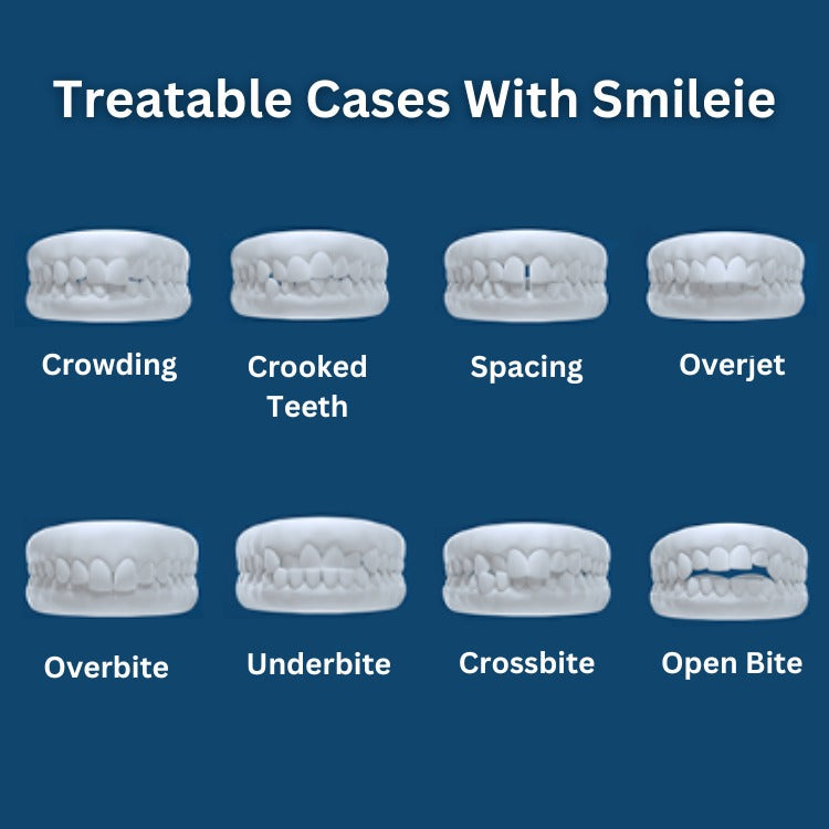 Treatable cases with smileie